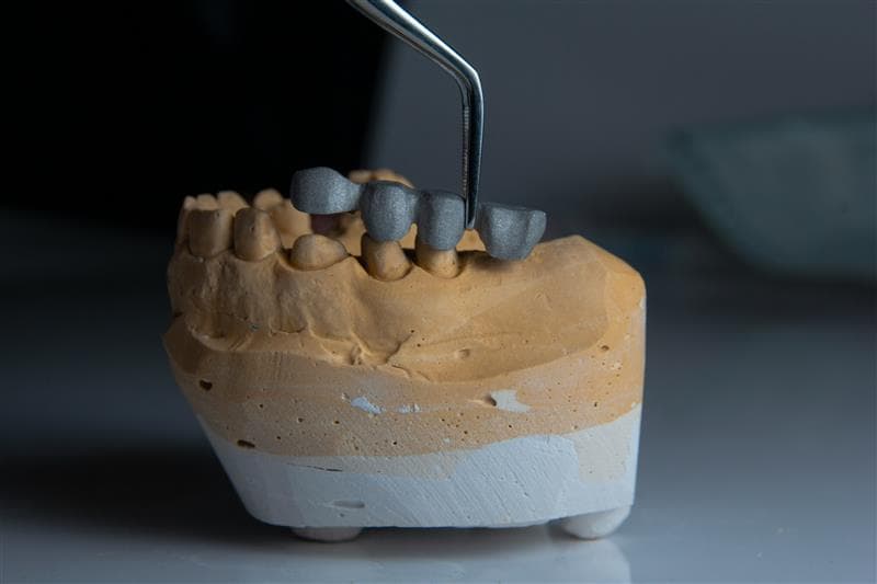 Dental Crowns