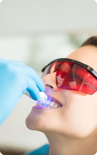 Teeth Whitening